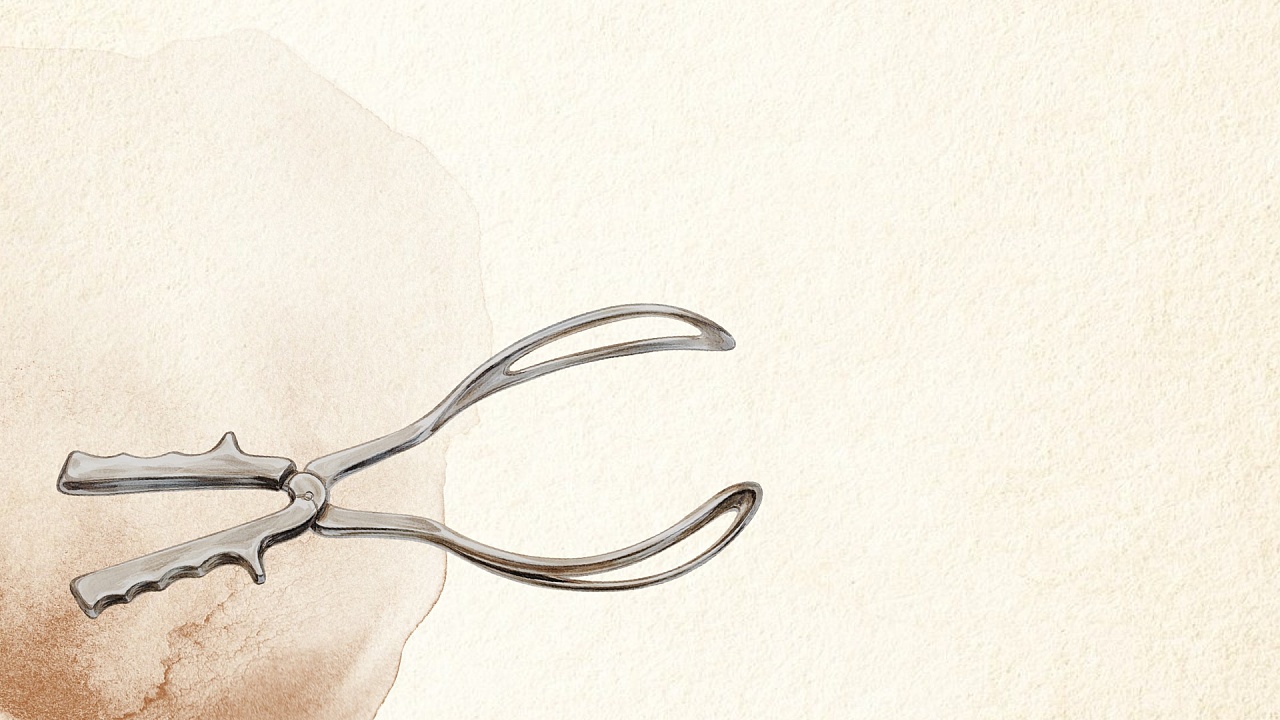 Секрет на миллион: история акушерских щипцов
