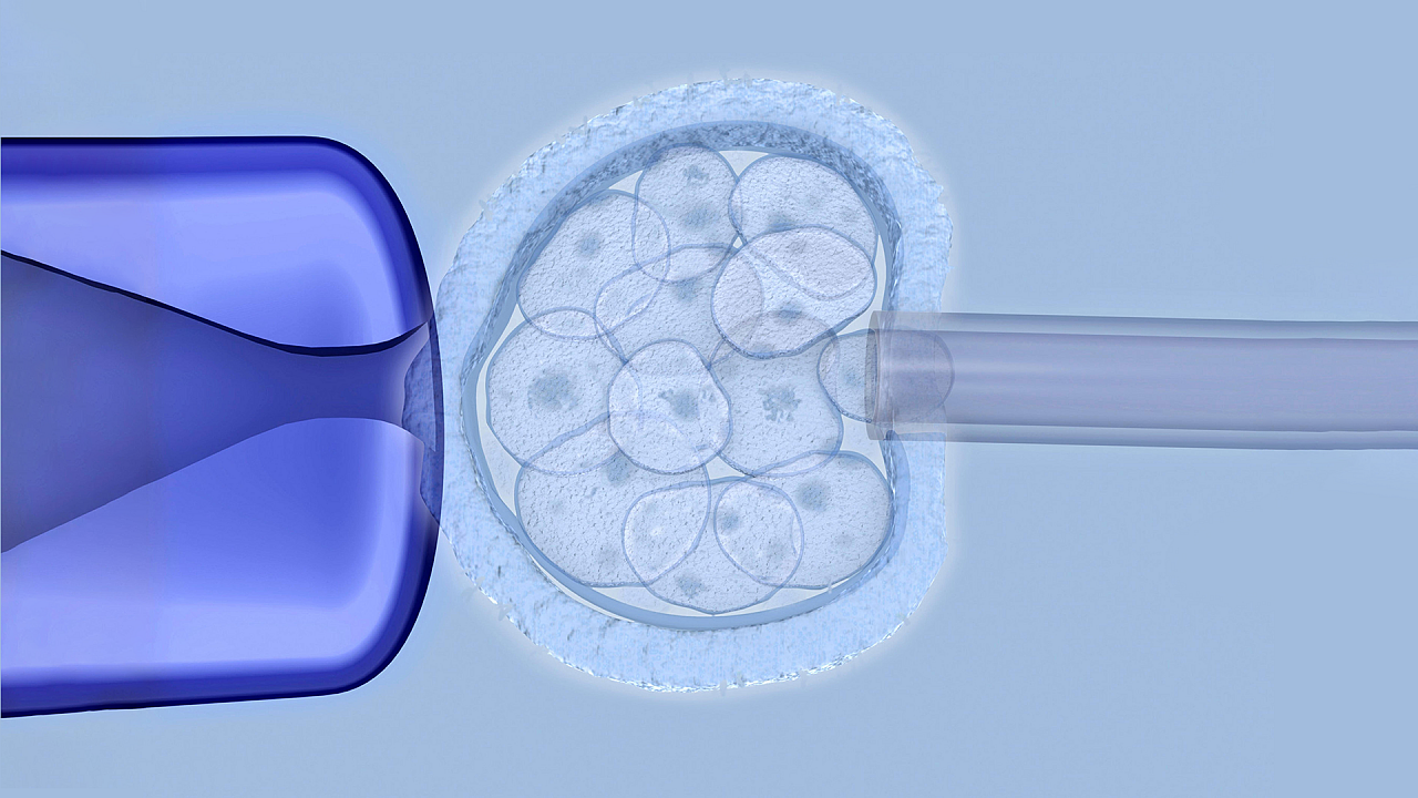 Повторные репродуктивные неудачи ЭКО: что мы знаем о факторах риска?
