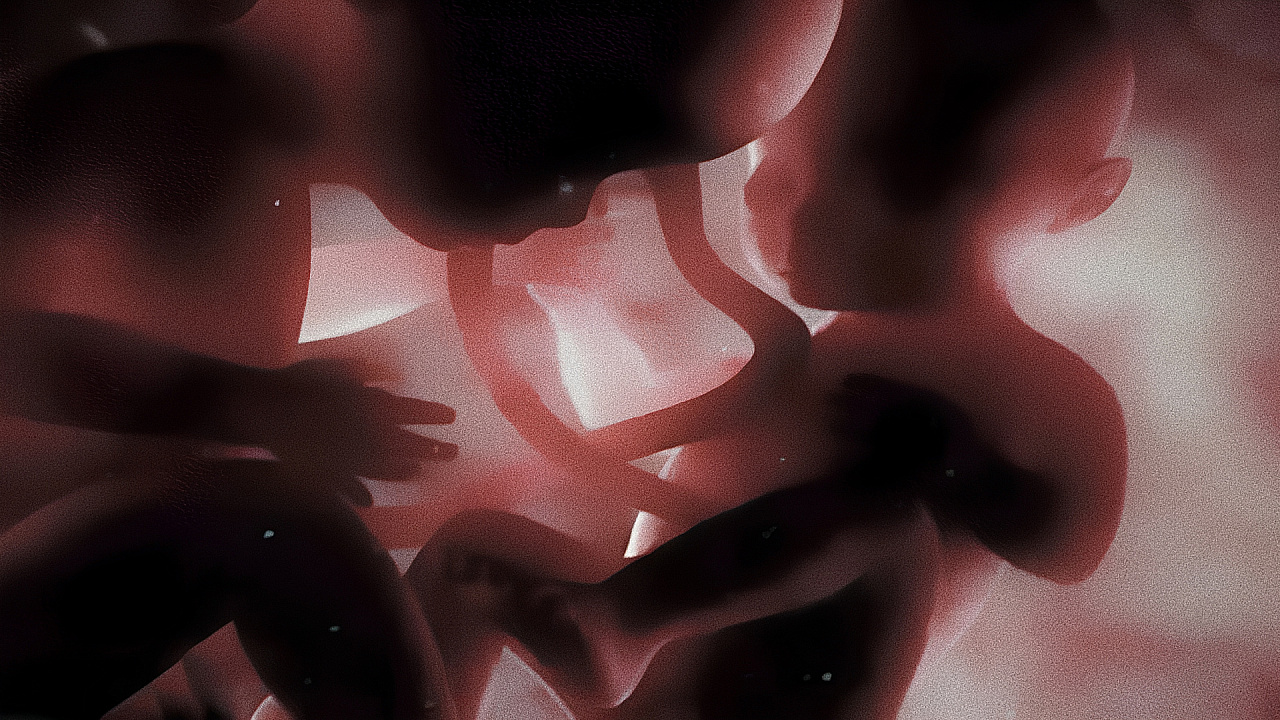 Синдром обратной артериальной перфузии: какую тактику выбрать