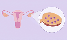 Как организм решает, какой фолликул станет доминантным?