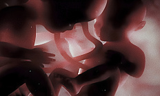 Синдром обратной артериальной перфузии: какую тактику выбрать