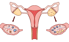 Как синдром поликистозных яичников влияет на функционирование вегетативной нервной системы?