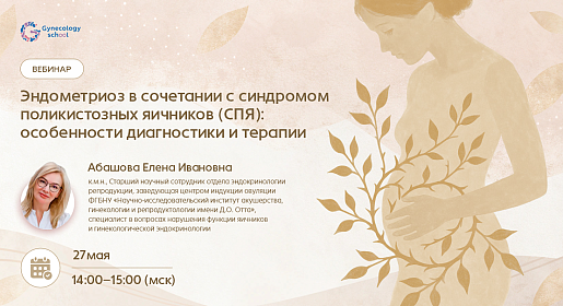 Эндометриоз в сочетании с синдромом поликистозных яичников (СПЯ): особенности диагностики  и терапии 