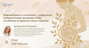 Эндометриоз в сочетании с синдромом поликистозных яичников (СПЯ): особенности диагностики  и терапии 